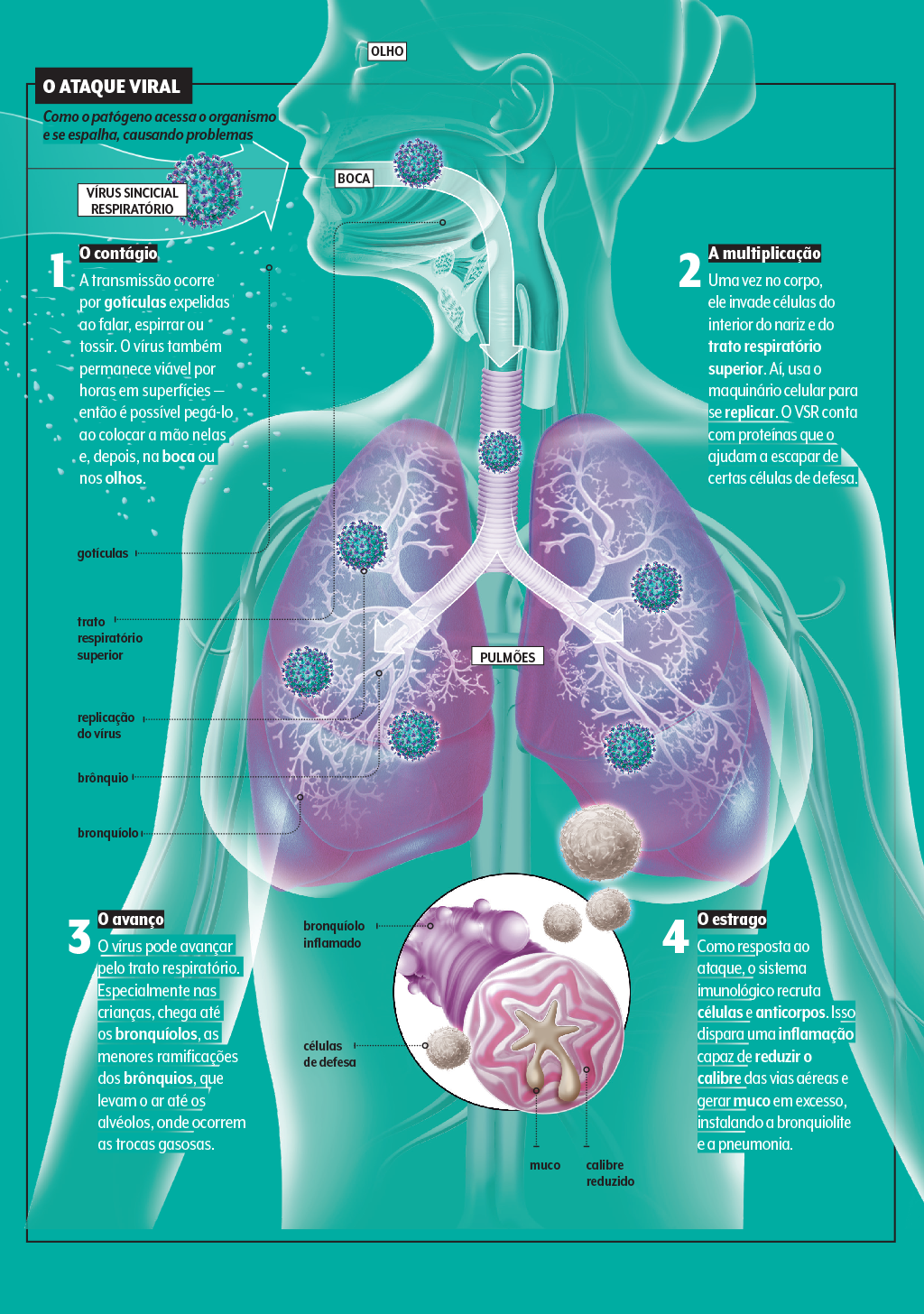 virus-vsr-sintomas
