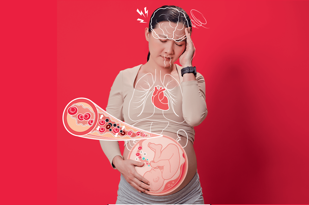 pre-eclampsia-o-que-e