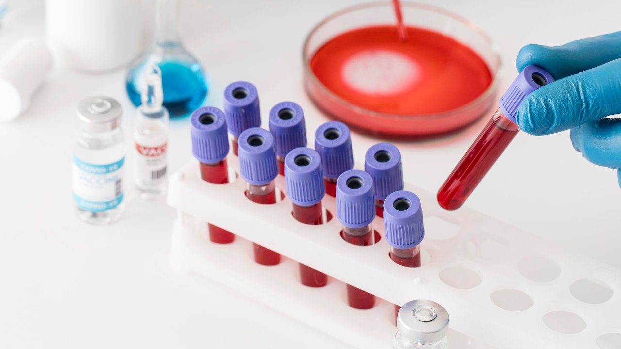 anti-hbs-exame-sangue