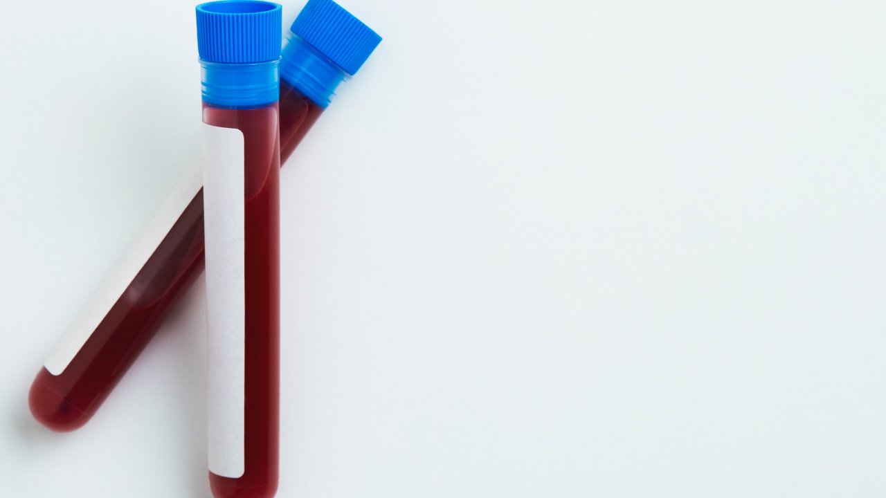 exame-sangue-creatinina