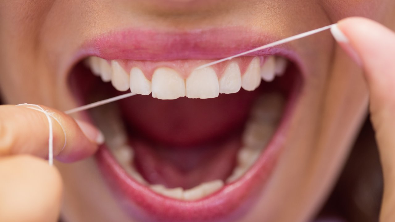 fio-dental