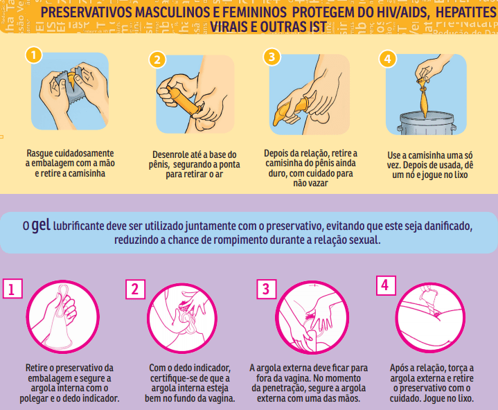 saude-medicina-sexo-prevencao-preservativo-feminino-interno-modo-de-usar