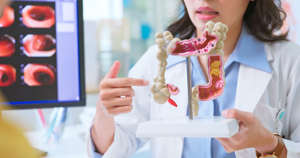 Por que você não deve fugir da colonoscopia e do exame de fezes