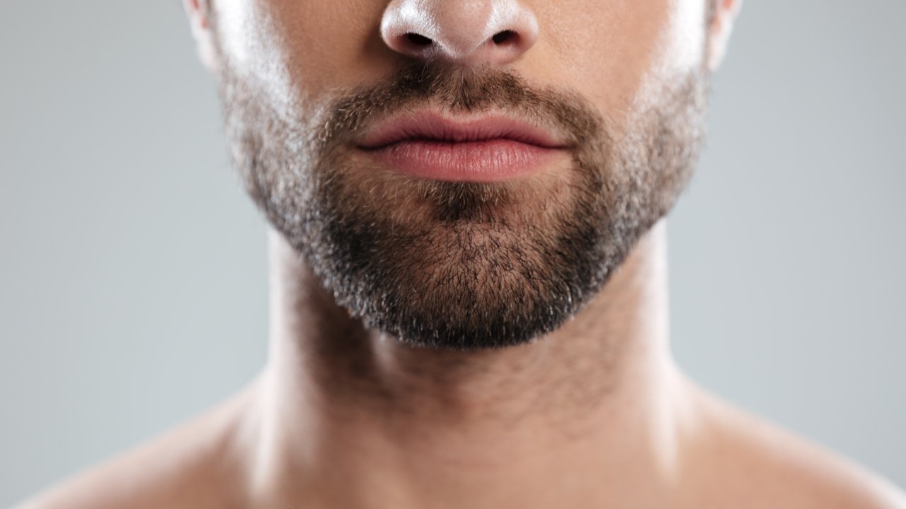 saude-autoestima-dermatologia-homem-barba-transplante