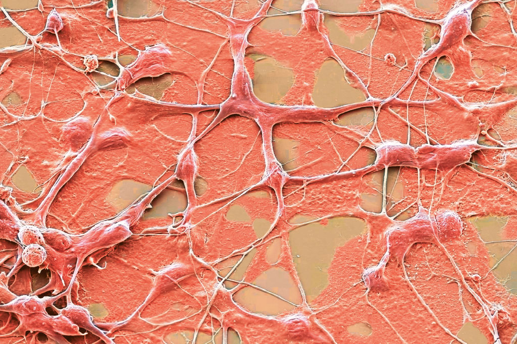 Zoom: a inteligência natural