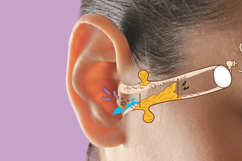 Cera de ouvido: entenda como ela se forma e para que serve