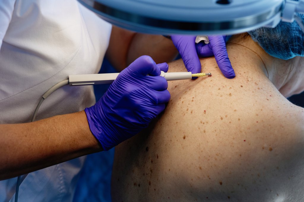 O exame de pele que revela o invisível: diagnóstico rápido de doenças e câncer