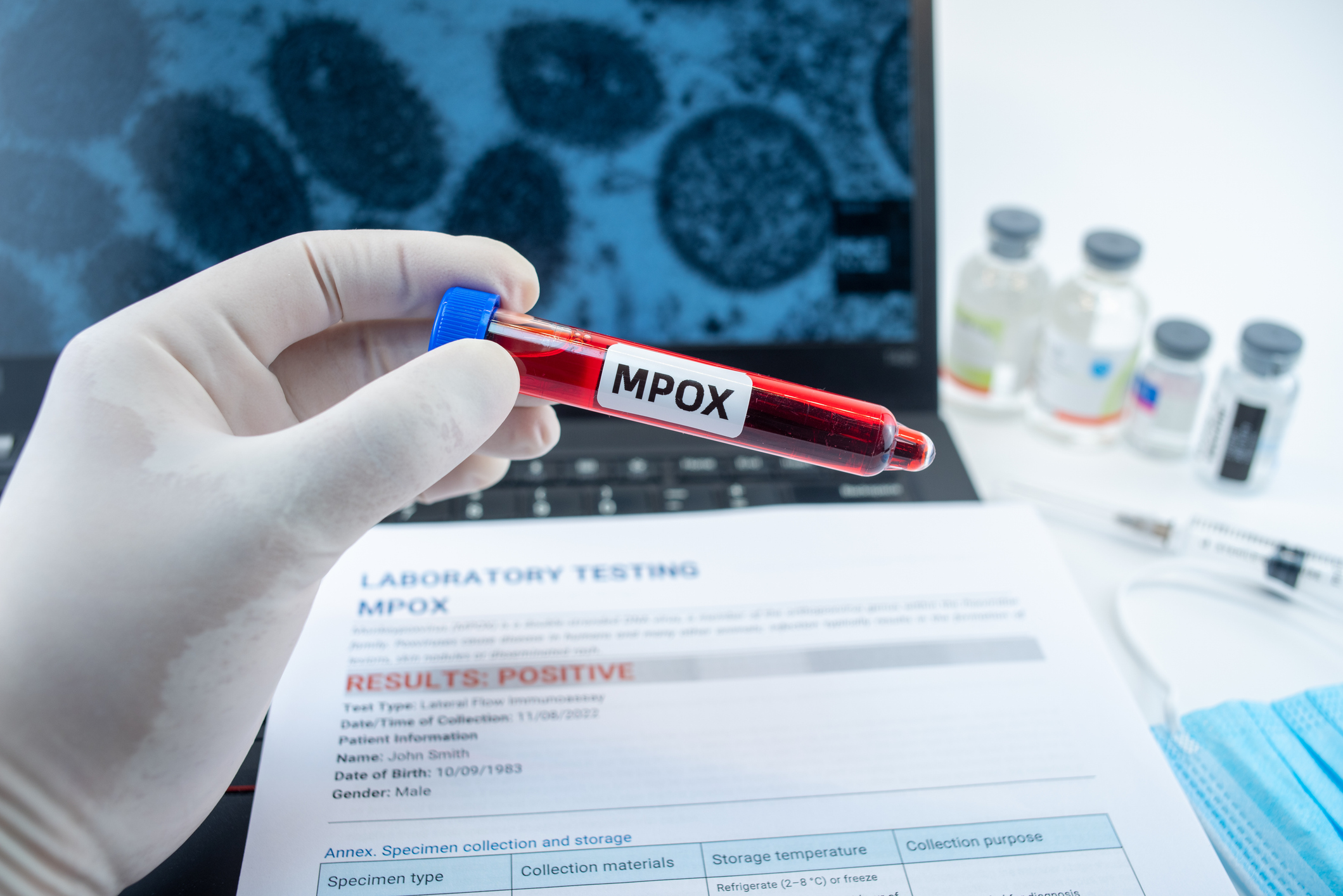 Mpox supera 80 casos no Brasil e novo estado é afetado